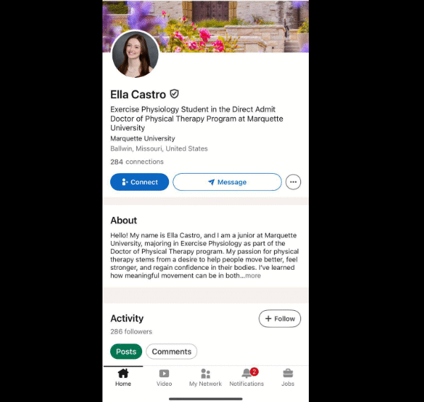284 Connection Linkedin | 2 Year Old | No Issue